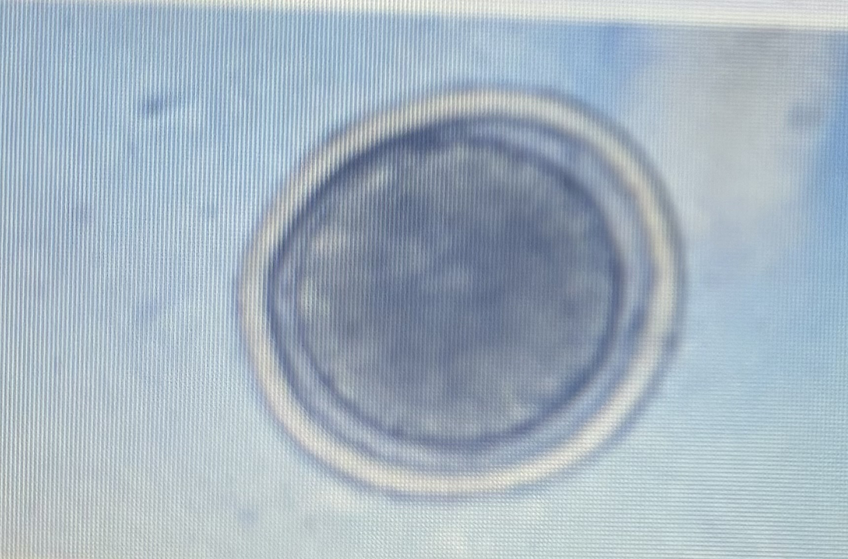 <p>ascarid </p><p>Host species: cat</p><p>Size: 65-75 um </p><p>Prepatent period: 42-56 days </p><p>Transmission: ingestion trans mammary </p><p></p>