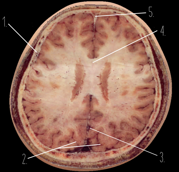 <p>5?</p>