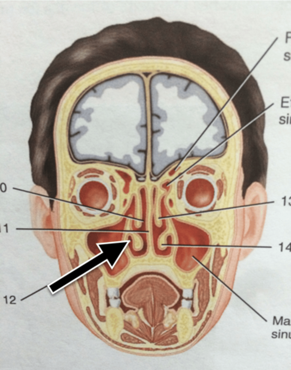 knowt flashcard image