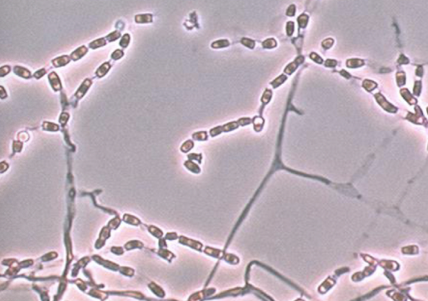 <p>Coccidioides immitis</p>