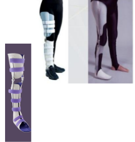<p>Indications for a total surface bearing/thermoplastic orthosis?</p>