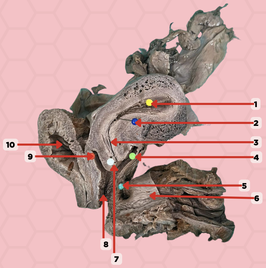 <p>Identify the structure labeled as 4.</p>