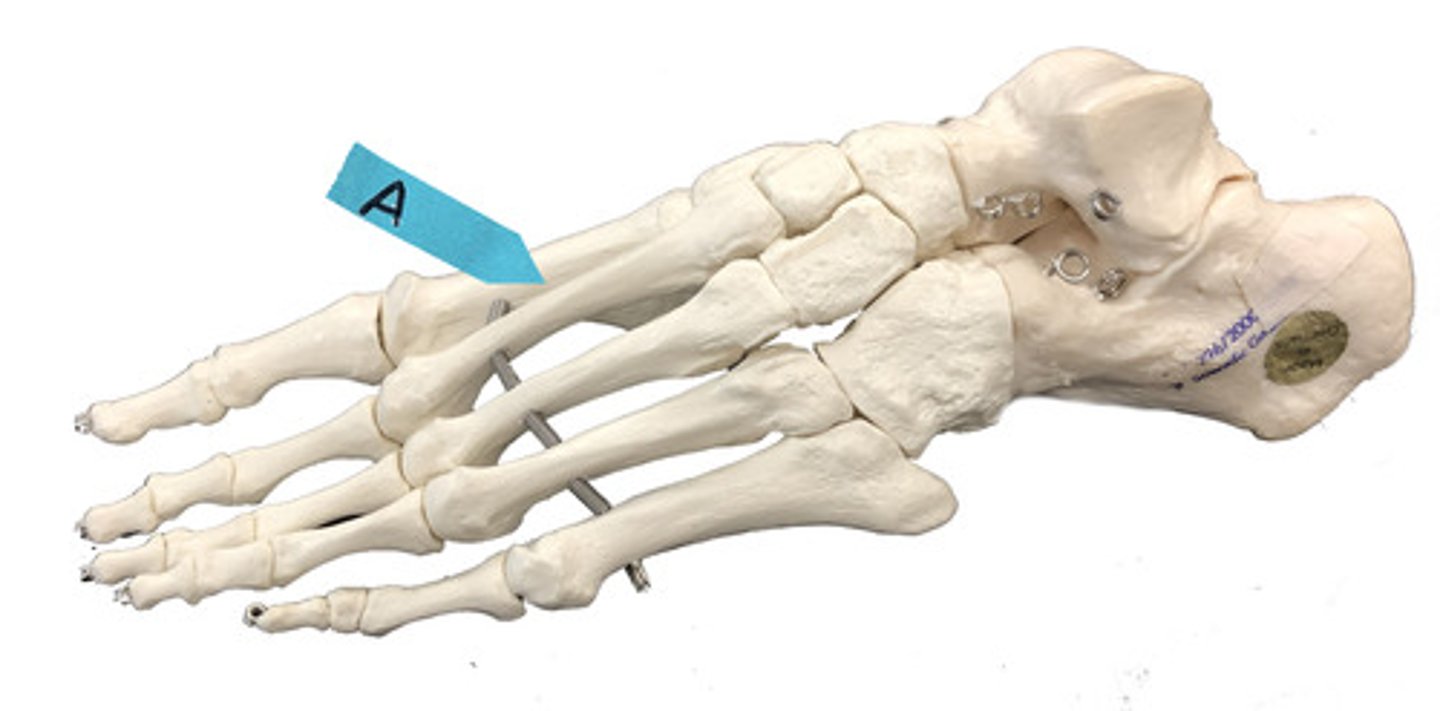 <p>Identify this bone.</p>
