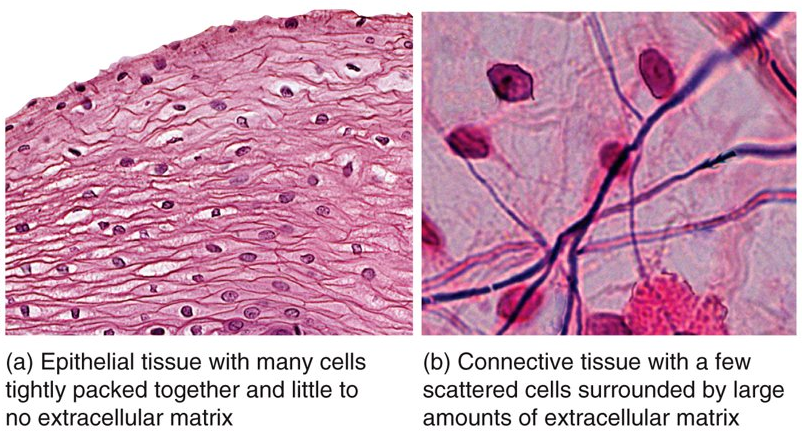 <p>epithelial tissue: many cells are tightly packed together with little or no extracellular matrix​ epithelial tissue has no blood vessels​ almost always form surface layers and are not covered by another tissue​</p><p>connective tissue: a large amount of extracellular material separates cells ​ have significant networks of blood vessels​</p>