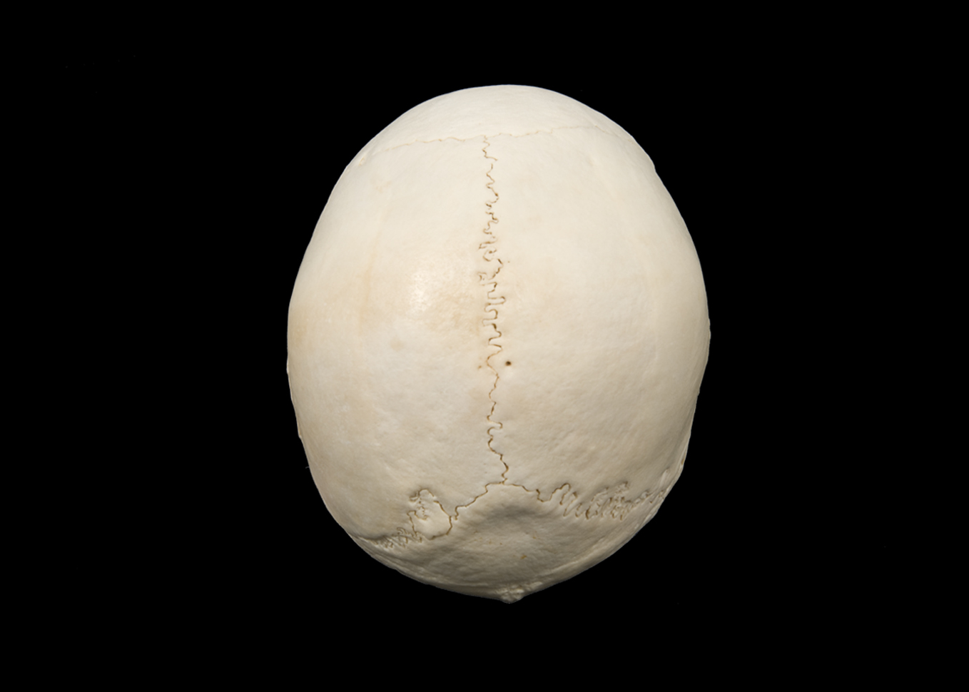 <p>top suture is called </p>