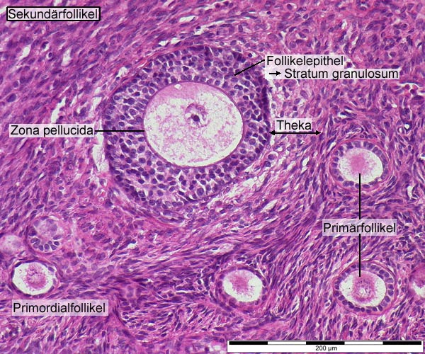 <p>Här bildas följande strukturer:</p><ul><li><p>Granulosaceller börjar utsöndra vätska vilket bildar ett hålrum → antrum. </p></li><li><p>Stratum granulosum blir tjockare (granulocyter)</p></li><li><p>Zona pellucida bildas. </p></li><li><p>Theca-lager bildas. </p></li></ul>