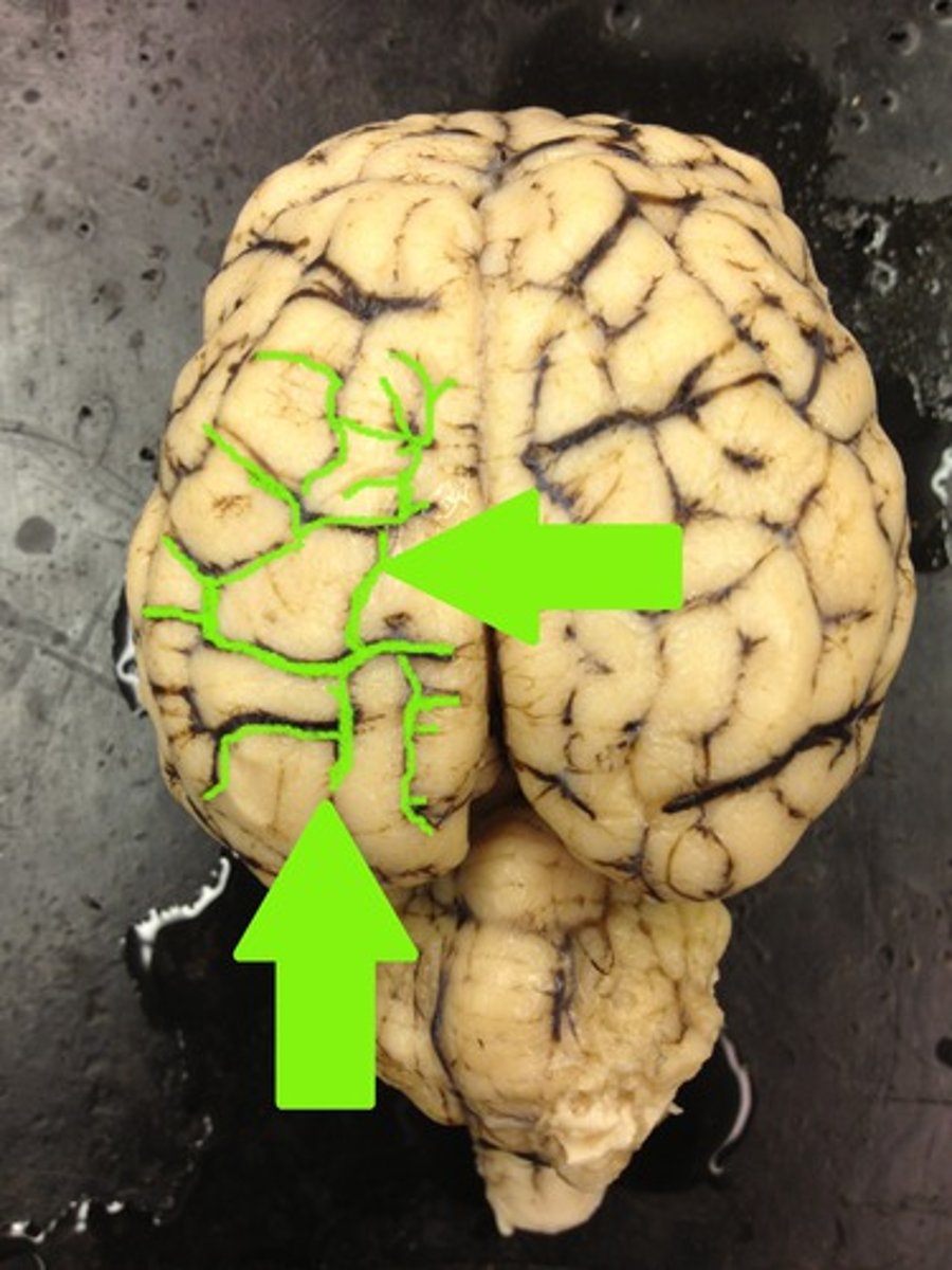 <p>folds diving inward, the grooves of the brain</p>