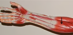 <p>What muscle is this?*****</p>