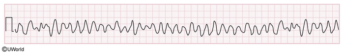 <p>72F with this ecg. what do you do next></p>