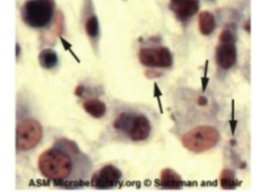 <p>Which type of virus does CPE detect pink eosinophilic cytoplasmic inclusion bodies arrows and cell swelling</p>