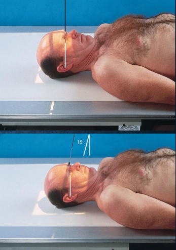 <ul><li><p>a similar but magnified image when patient cannot be positioned for PA or PA axial</p></li><li><p>patient and position part:</p><ul><li><p>supine</p></li><li><p>MSP centered to midline</p></li><li><p>MSP and OML perpendicular to IR</p></li></ul></li><li><p>respiration suspended</p></li><li><p>CR:</p><ul><li><p>AP: perpendicular, enters nasion</p></li><li><p>AP axial: 15 degrees cephalad, enters nasion</p></li></ul></li><li><p>collimation:</p><ul><li><p>1 inch beyond the skin line of the skull</p></li></ul></li></ul><p></p>