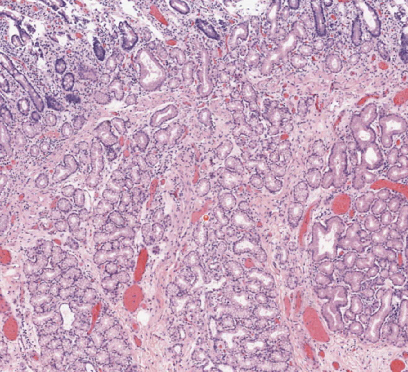 <p>Pancreas</p>