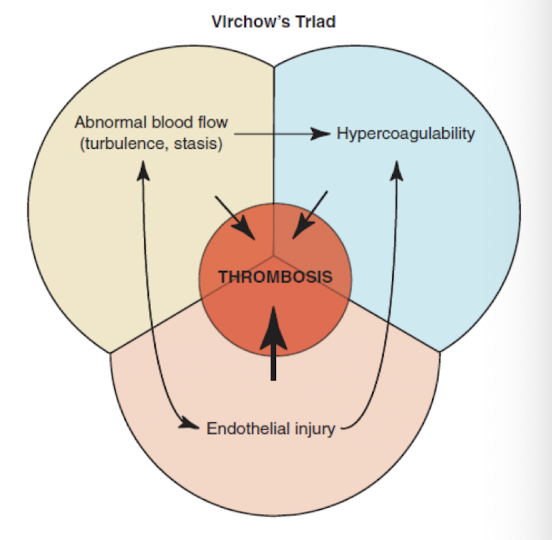 <ol><li><p><strong><u>vascular injury</u></strong> → inflammation</p></li><li><p><strong><u>altered blood flow</u></strong> → stasis or turbulence</p></li><li><p><strong><u>hypercoagulability</u></strong> → inherited or acquired</p></li></ol><p></p>