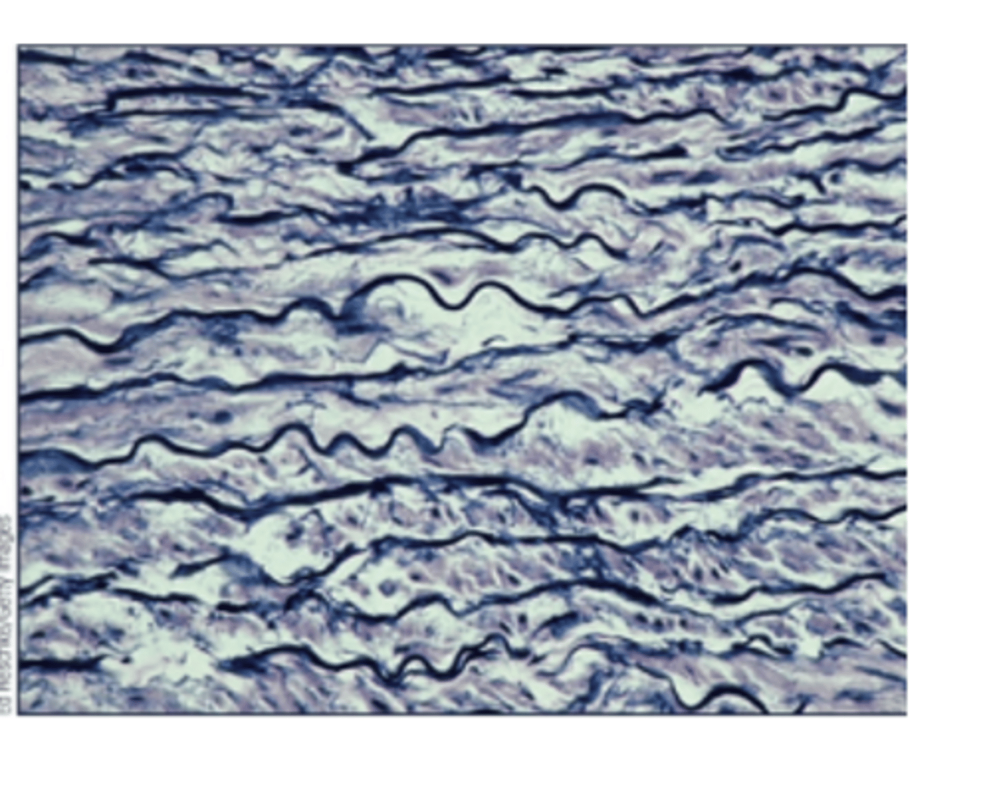 <p>- Made of mostly elastic fibers, fibers run parallel, and designed to stretch and snap back.</p><p>- Function: Allows structures to return to original size and shape following expansion, (extension or distension).</p><p>- Location: Lungs and walls of large arteries</p>