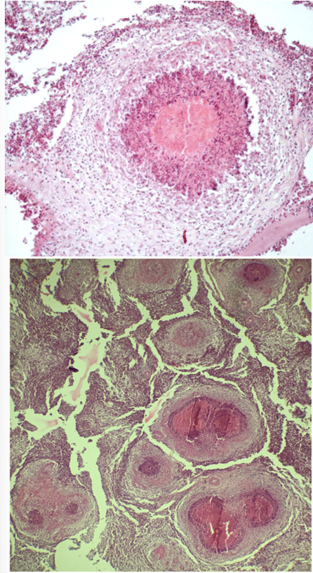 <p>This is?</p><img src="https://knowt-user-attachments.s3.amazonaws.com/9ab5f72f-01e5-44d3-b7bb-1c46332257a7.png" data-width="50%" data-align="center"><p></p>