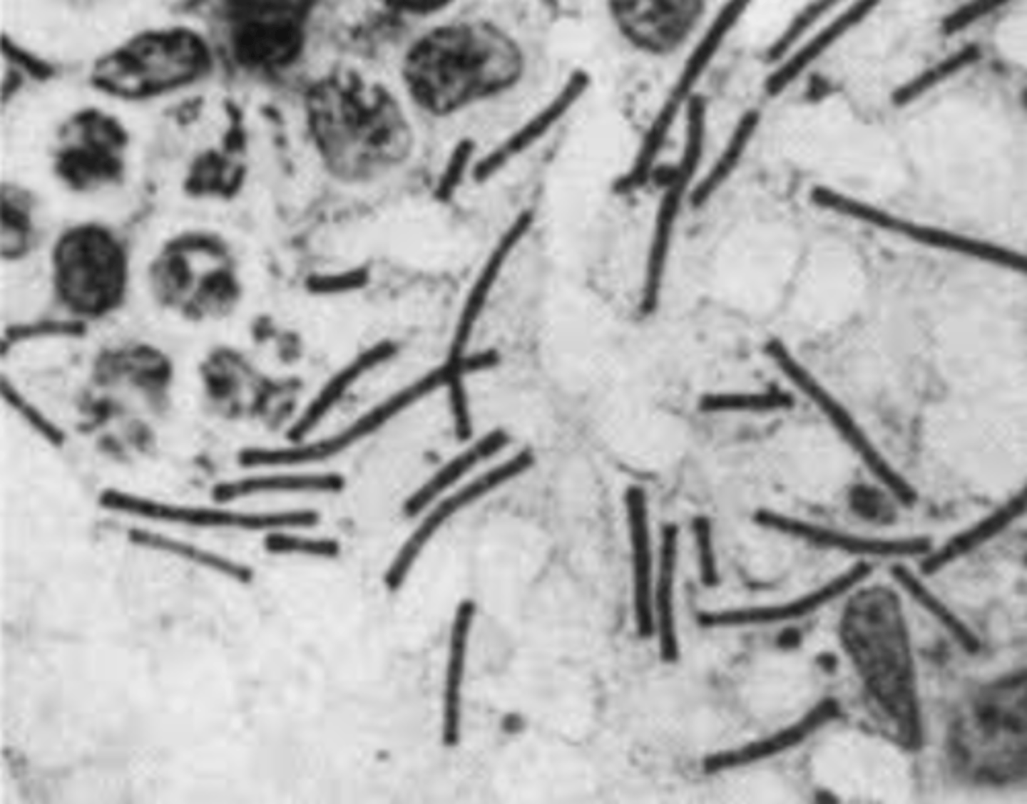 <p>Taking a magnified photograph of small object through attaching a camera to the ocular of a compound microscope so as to show a minute details of the physical evidence.</p>