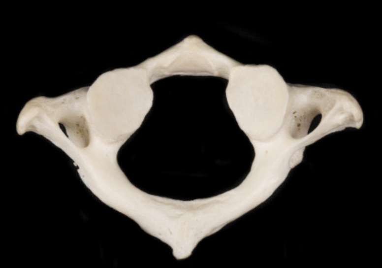 <p>Identify the part of the vertebra and explain what diagnostic features helped you reach your conclusion.</p>