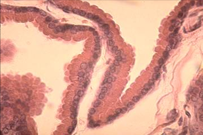 <p>Identify the structure:</p><p>Specie:</p><p>Lined by:</p>
