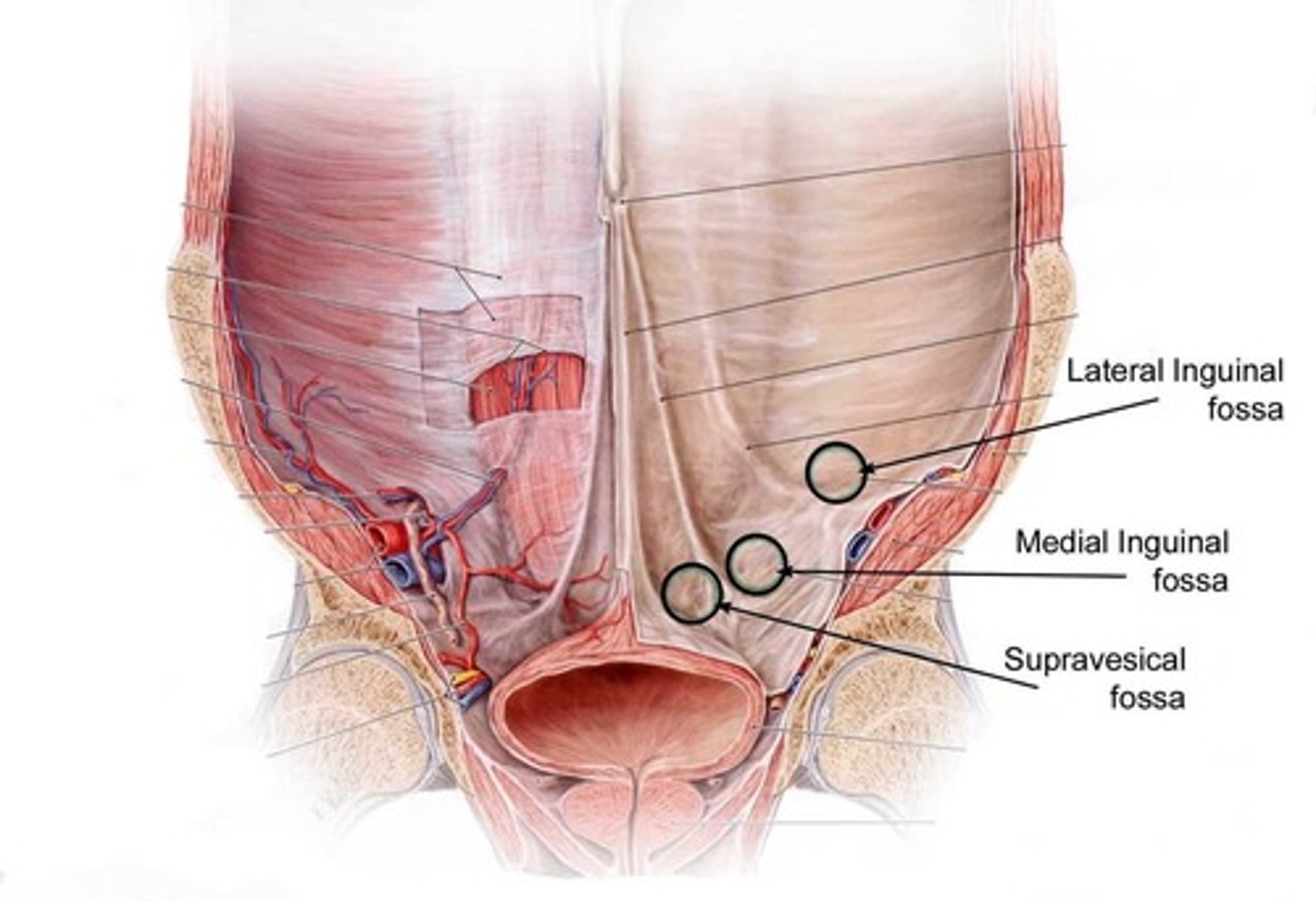 <p>The supravesical fossa is a peritoneal reflection from AWW onto what? </p>