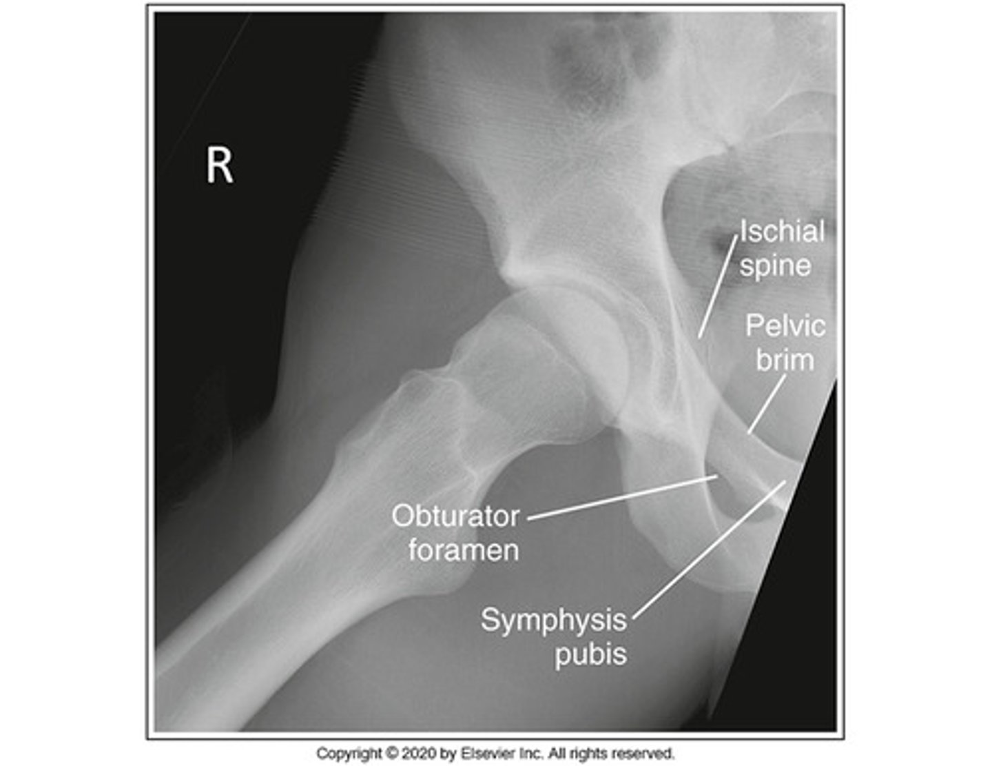 <p>Identify the projection:</p><p>AP Hip</p><p>Axiolateral Hip (Danelius-Miller)</p><p>AP oblique hip (Modified Cleaves)</p><p>Lateral hip (Lauenstein)</p>