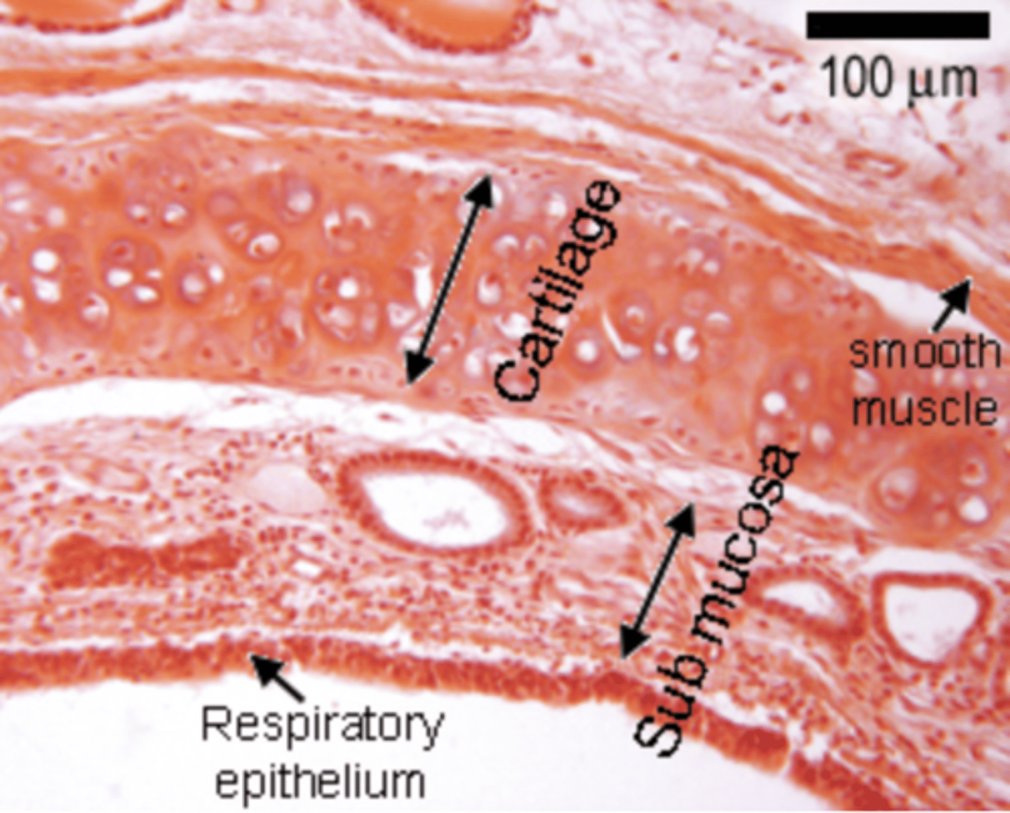 <p>Respiratory epithelium: Found in most parts of the respiratory tract, consisting of pseudostratified ciliated columnar epithelium with goblet cells for mucociliary clearance.</p><p>Olfactory epithelium: Specialized epithelium in the nasal cavity for detecting odors.</p>