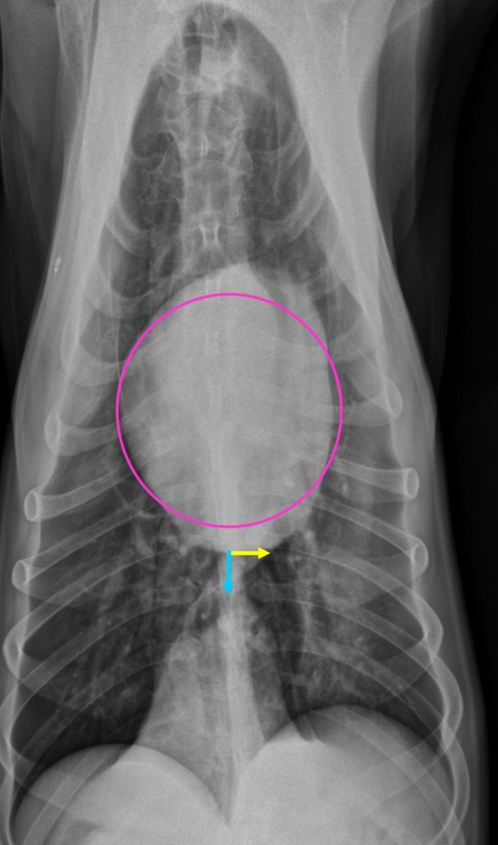 <p>-apex slightly left of midline</p><p>-circular to ovoid heart</p><p>-cupula and heart separation</p>