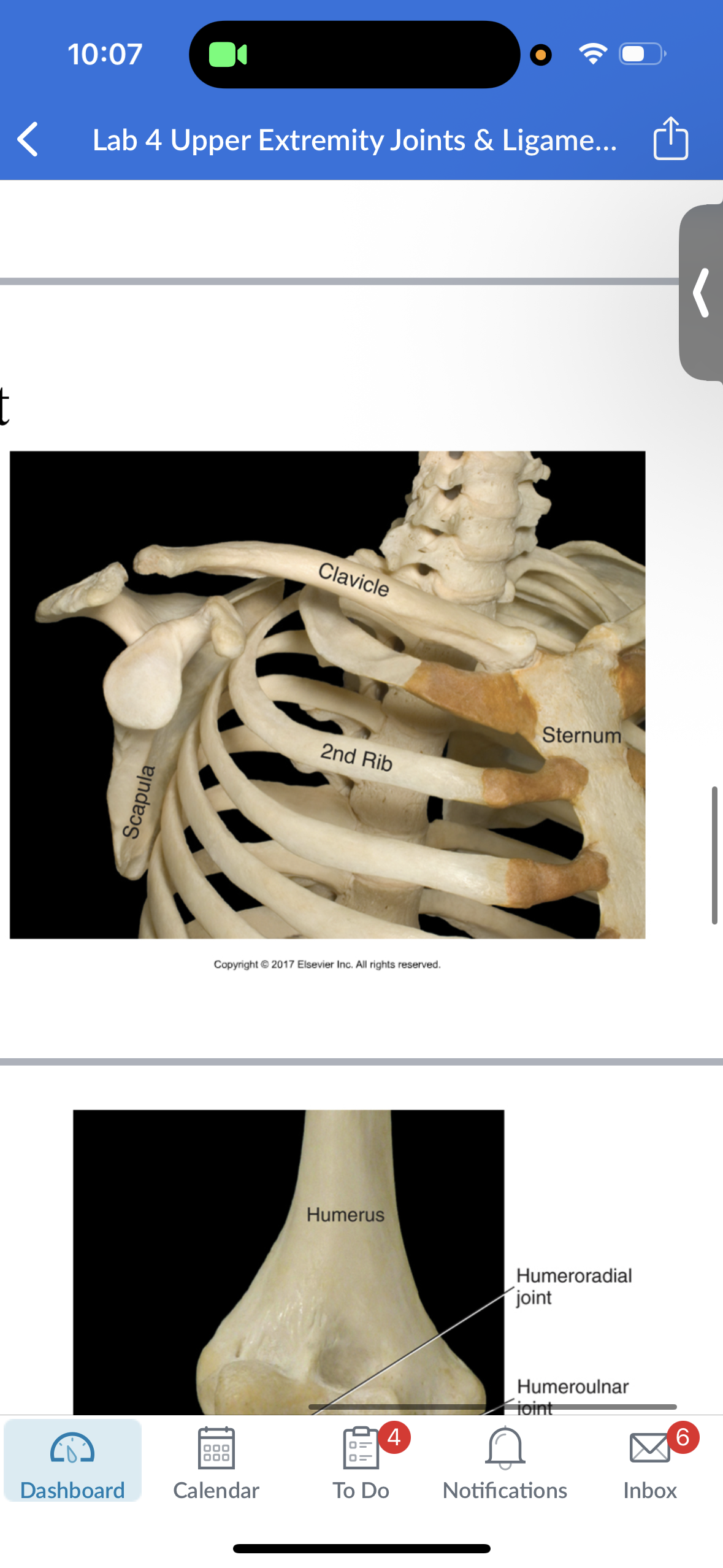 <p>name of this ligament?</p>