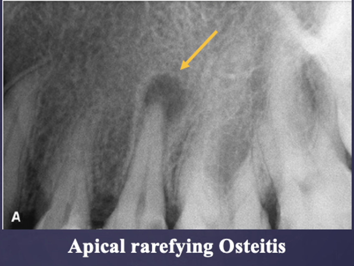 <p>Well defined or poorly defined?</p>