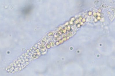 <ol start="58">
<li>Characteristics of erythrocyte casts</li>
</ol>
