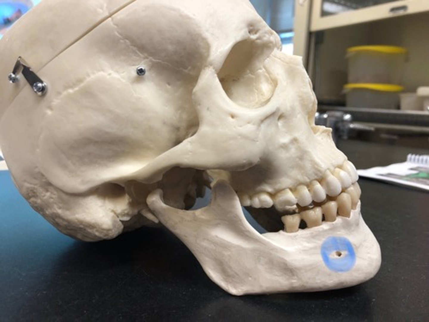 <p>Holes on side of the body of mandible (outside)</p>