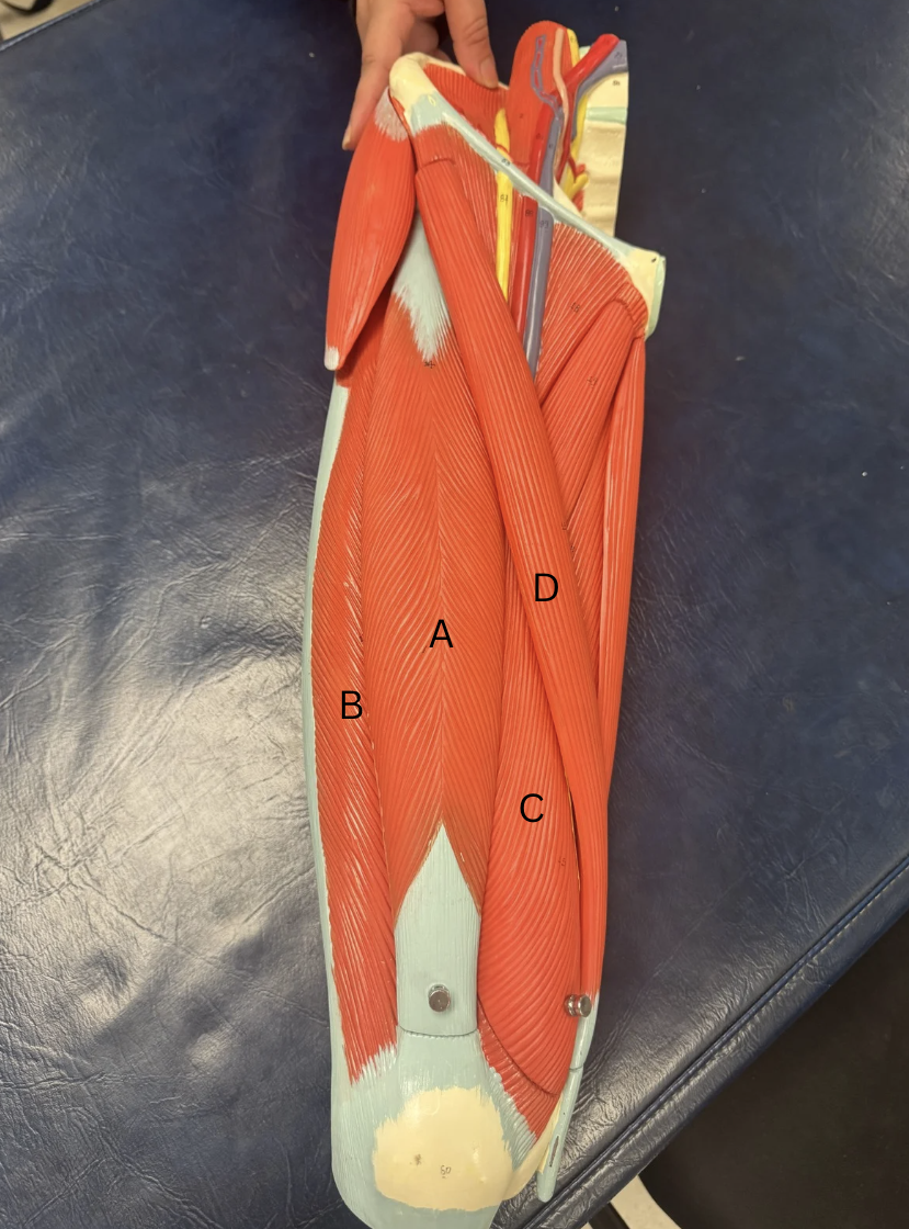 <p>Label the quad muscles</p>