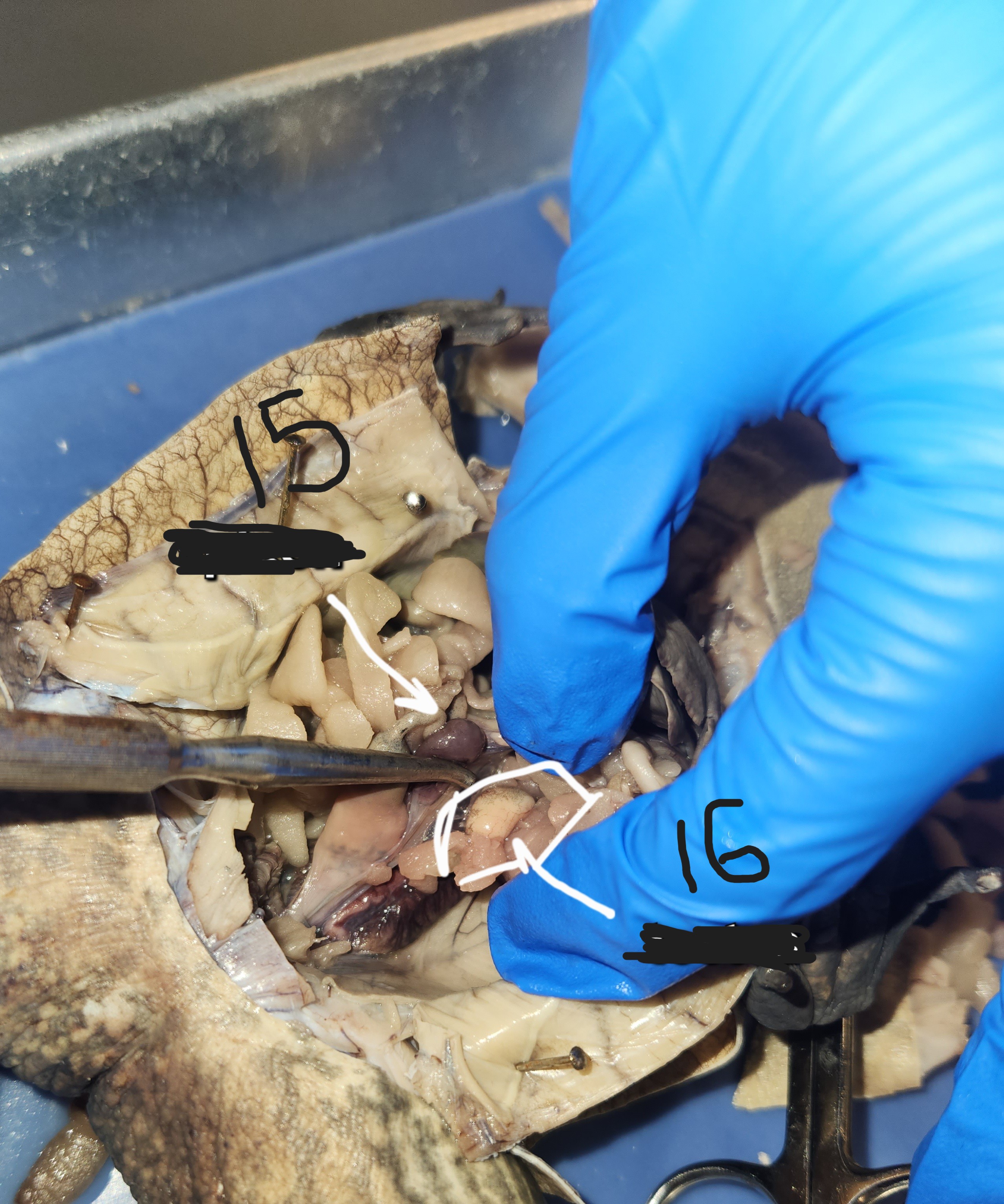 <p>What is option 15</p>