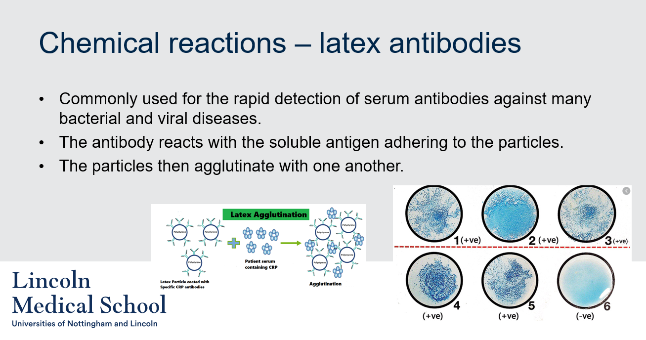 <p>The latex antibody test is commonly used for the rapid detection of serum antibodies against many bacterial and viral diseases. It involves the reaction of the antibody with the soluble antigen adhering to the particles, which then agglutinate with one another.</p>