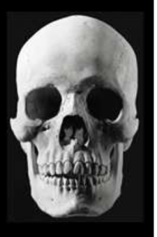 <p>Identify the zygomatic process </p>