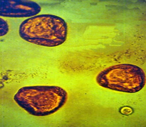 Host: cattle, sheep, goats
Intermediate host: grain mites
Location: small intestine
Transmission: ingestion of infective 
Diagnosis: fecal float
expansa is triangular or pyramidal in shape
Treatment: Morantel, Niclosamide, pasture rotation
Zoonotic?: no
Common name: ruminant tapeworm 