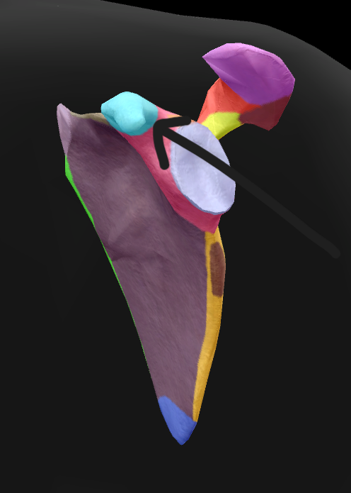 term image