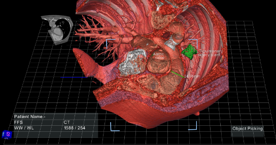 <p>Only for <strong>inherently 3D data</strong> (e.g., volume data) and not for ordinary 2D data like pie charts.</p>