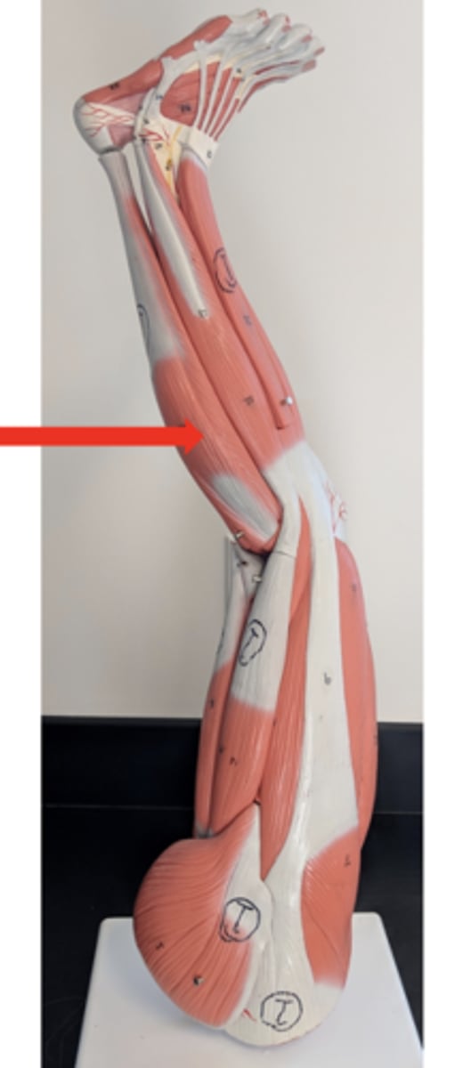 <p>what is this?</p>