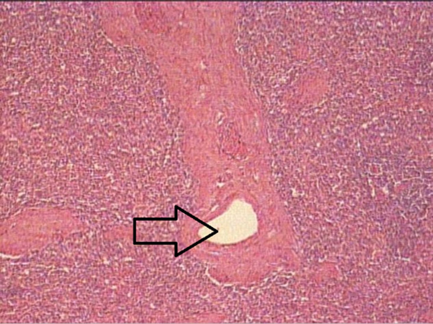 <p>The arrow is pointing at:</p>