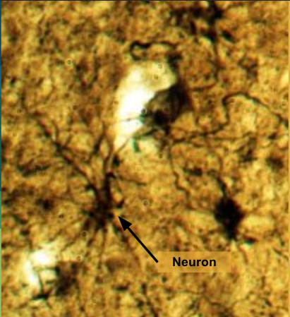 <p>cells that help transport electrical impulses to and from the brain - -contains long branched neurons and smaller neuroglia</p><p></p>