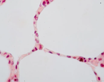 <ul><li><p>single layer of flat cells </p></li><li><p>usually forms membranes </p></li><li><p>lines body cavities </p></li><li><p>lines lungs and circulatory organs and ventral body cavities </p></li><li><p>forms serous membranes </p></li></ul><p></p>