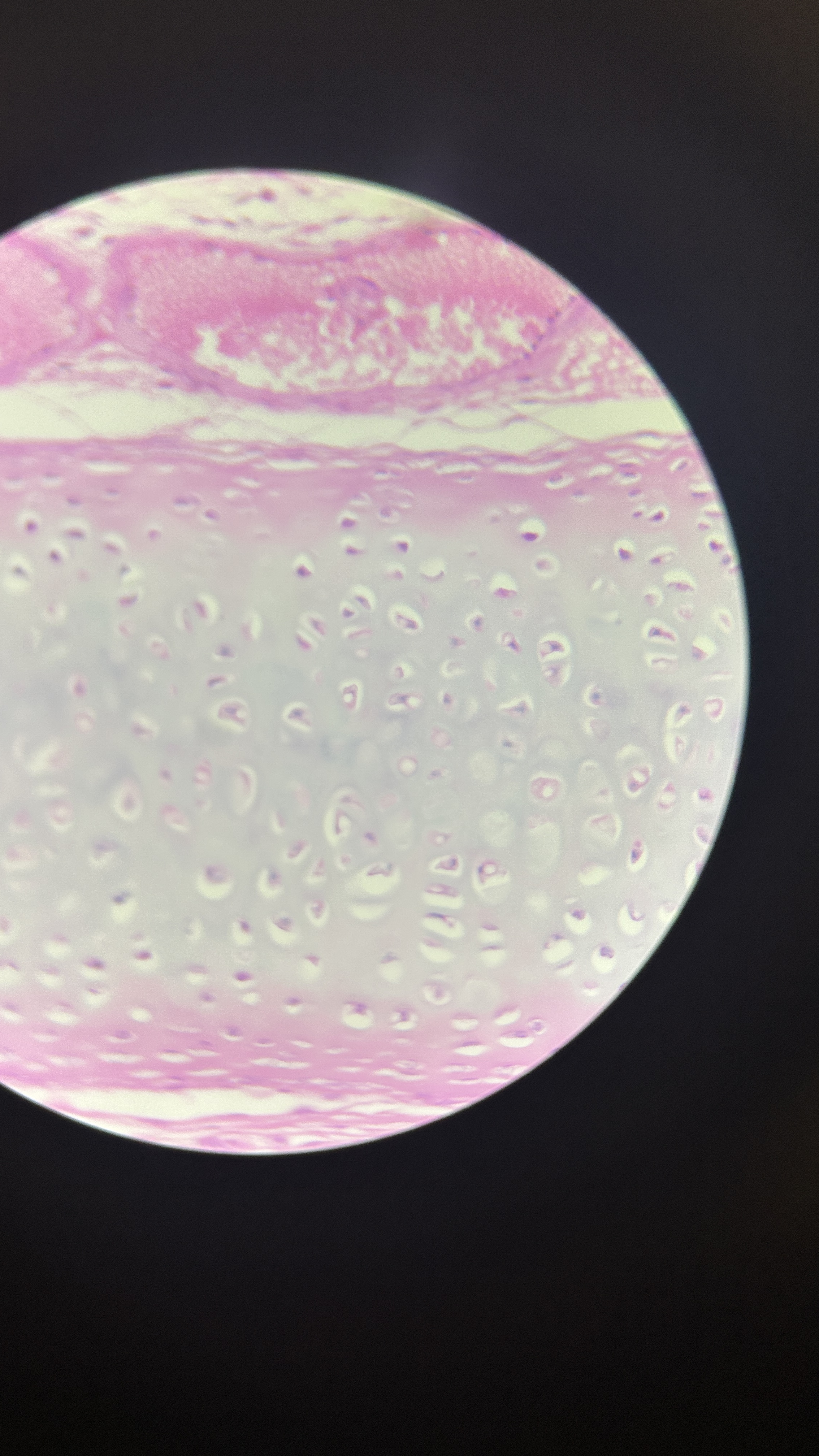 <p>What is the magnification level of the Hydraline Cartilage?</p>