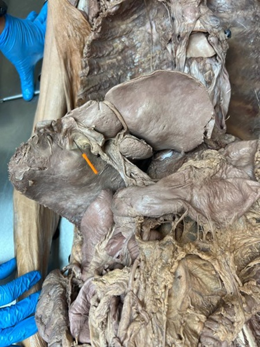 <p>fossa for gallbladder</p>