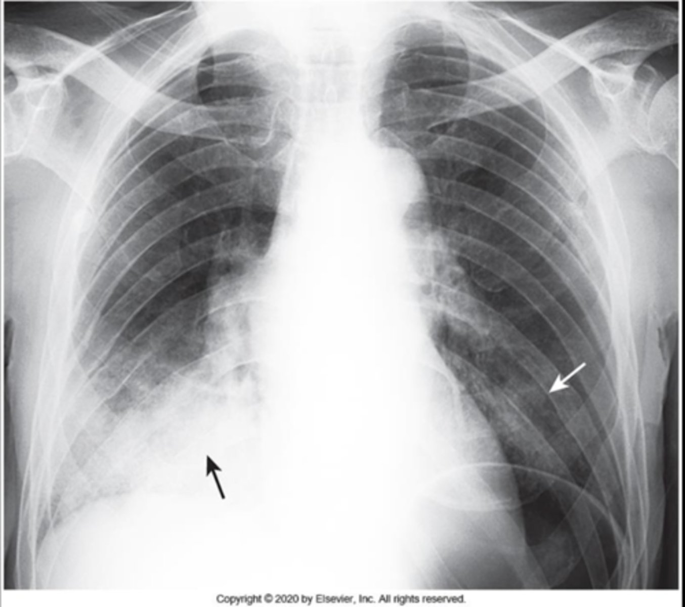<p>What is your diagnosis? Why?</p>