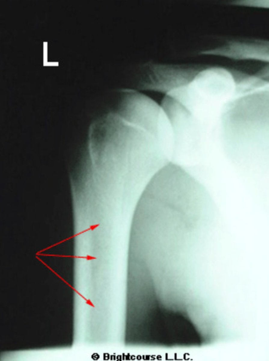 <p>What is being pointed out by the arrows in the image?</p>