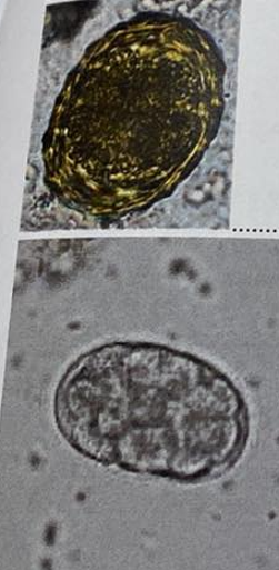 <p>Eggs found in pig examination, name and describe</p>