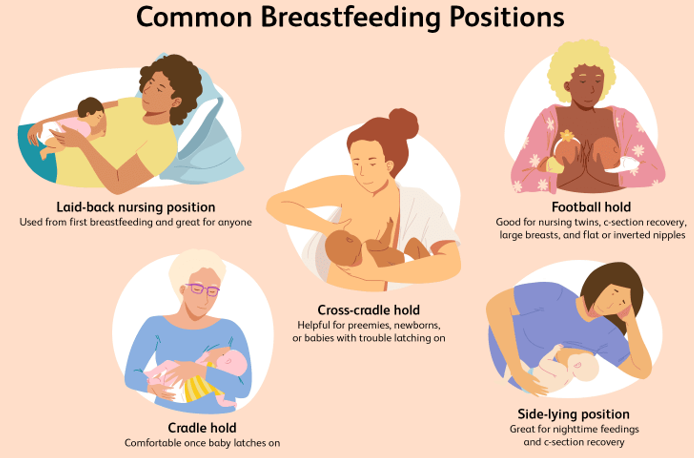 <ul><li><p class=""><strong>Breastfeeding or feeding of expressed human milk is recommended for all infants, including sick or premature infants.</strong></p></li><li><p class=""><strong>Breastfeeding Statistics (2019):</strong></p><ul><li><p class="">83.2% of infants started out receiving some breast milk.</p></li><li><p class="">78.6% were receiving breast milk at 1 month.</p></li><li><p class="">At 6 months, 55% of infants received any breast milk, and 24.9% received breast milk exclusively.</p></li></ul></li><li><p class=""><strong>Composition of Breast Milk:</strong></p><ul><li><p class="">Includes lactose, lipids, polyunsaturated fatty acids, and amino acids.</p></li><li><p class="">The concentration of iron in breast milk is lower than that of formula but has increased bioavailability, usually meeting the infant’s needs for the first 4 to 6 months.</p></li></ul></li><li><p class=""><strong>Monitoring Input &amp; Output:</strong></p><ul><li><p class="">Input is estimated based on feeding time, weight, and wet diapers.</p></li><li><p class="">Adequate output is approximately 1 mL/kg.</p></li></ul></li></ul><p></p>
