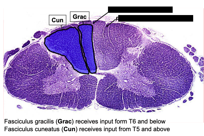 <p>what separates fasciculus cuneatus from gracilis?</p>