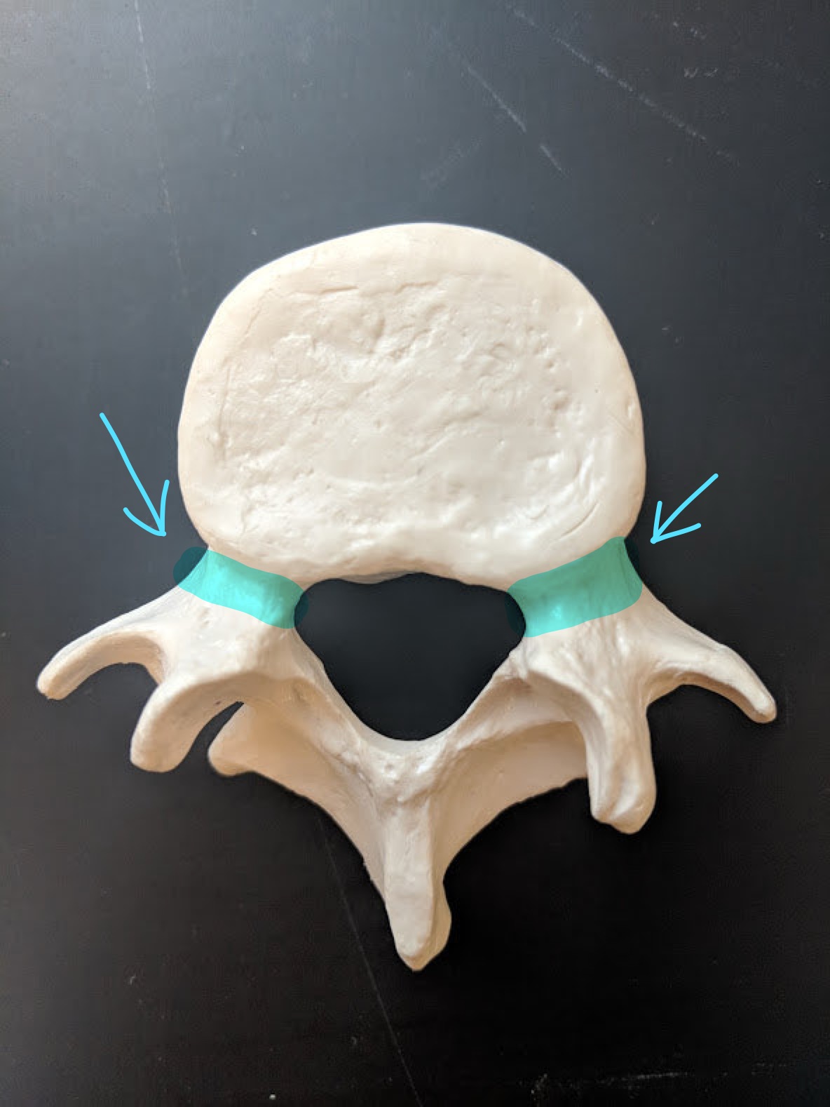 <p>Name this structure</p>