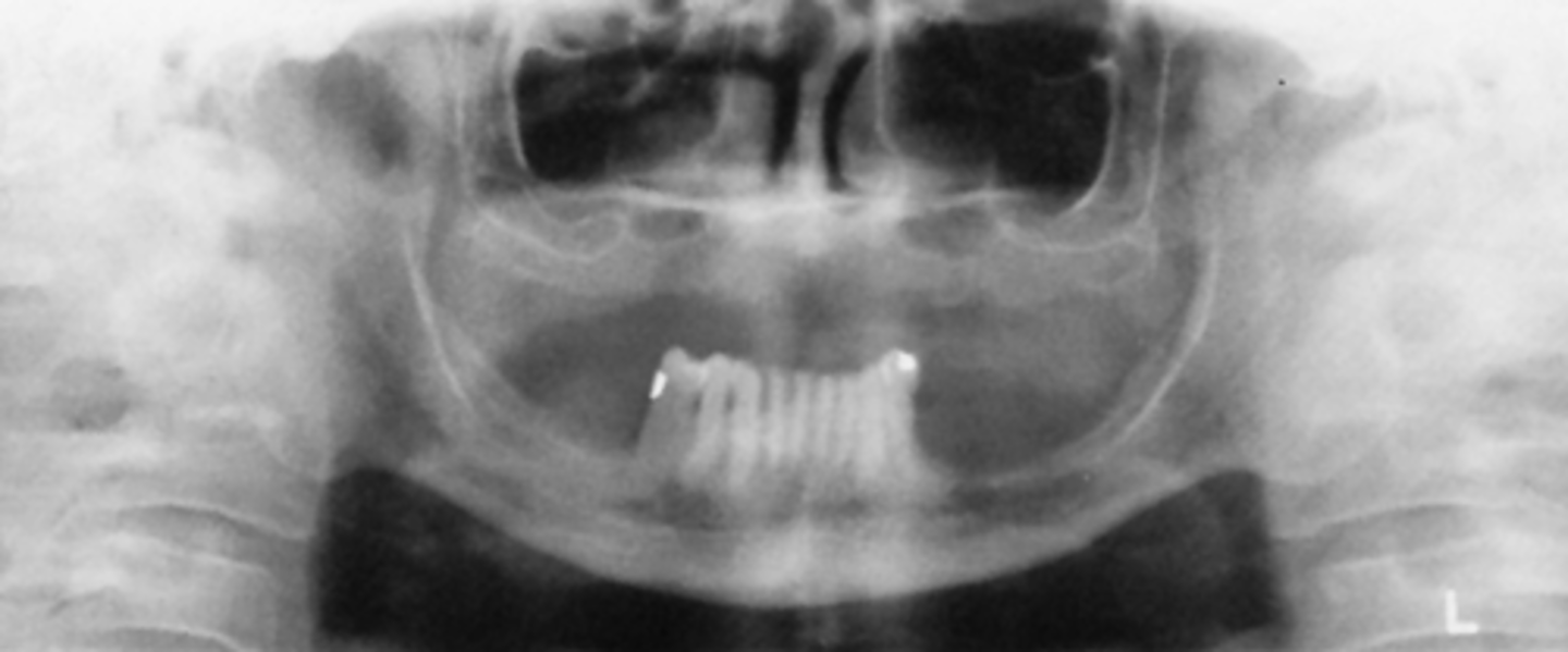 <p>What is the problem with the patient's positioning in this image?</p>